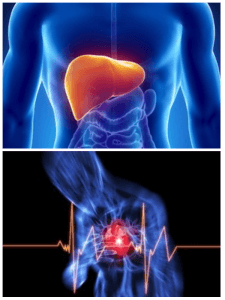 Cardiac angina and hepatic failure