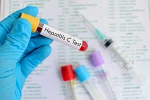 Hepatitis C