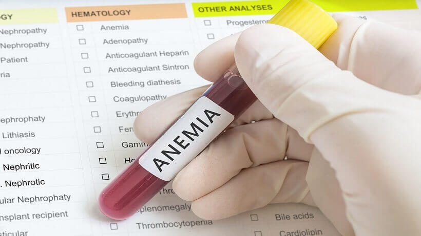 Anemia 